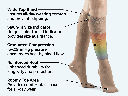3 sigvaris-971-dynaven-technical-specifications-graduated-compression.png