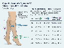 5 sigvaris-dynaven-vs-generic-compression-socks-comparison.png