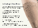 3 sigvaris-eversheer-thigh-high-sensinnov-grip-top-technical-features.png