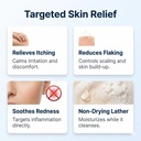dermazinc-soap-benefits-itching-redness-flaking-relief.webp