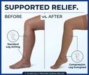 sigvaris-compression-stockings-edema-swelling-relief-before-after.webp