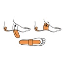  FasciaDerm System for Plantar Fasciitis