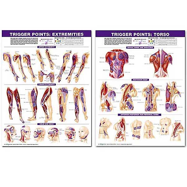 Trigger Points Chart Set 2nd Ed. 20 Inch x 26 Inch