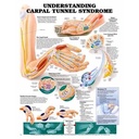 Understanding Carpel Tunnel Syndrome Anatomical Chart