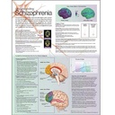 Understanding Schizophrenia Anatomical Chart