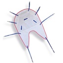 Bestcare Single Patient Disposable Support Sling