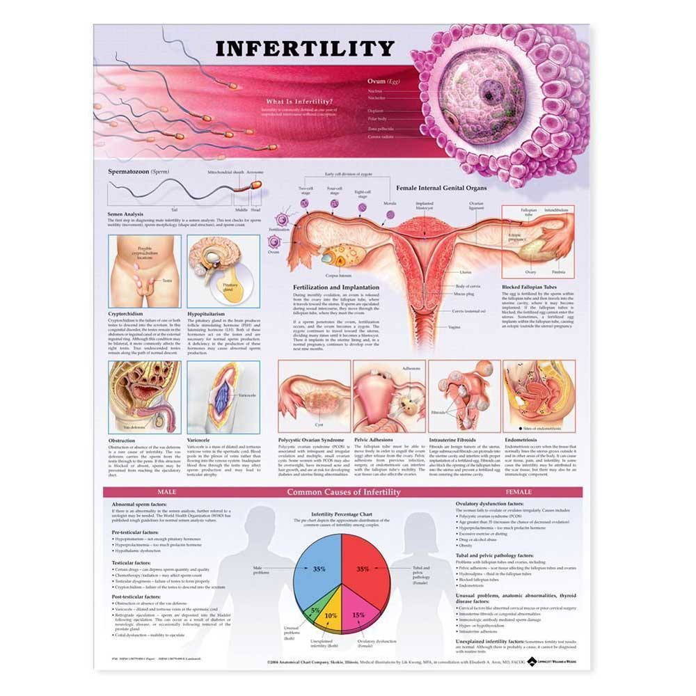 Infertility 2nd Edition Anatomical Chart-Paper