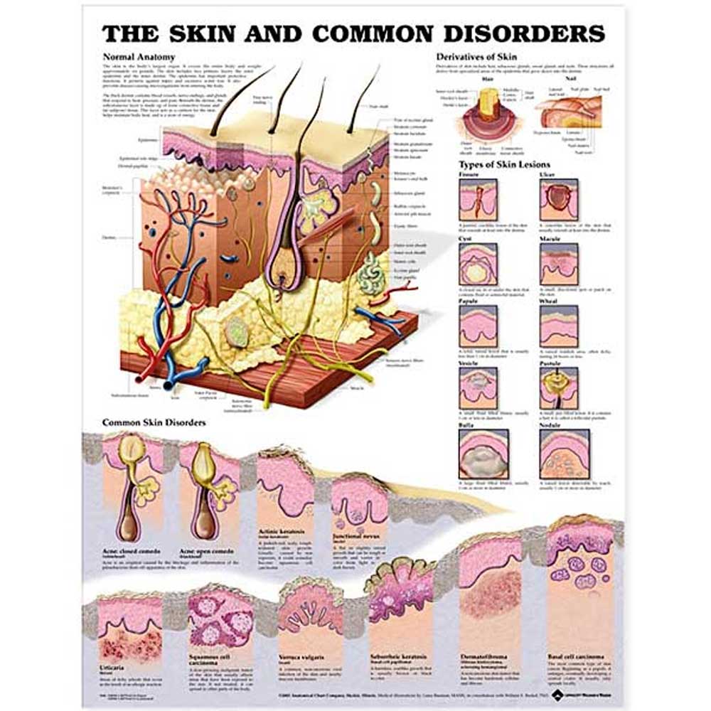 OPEN BOX The Skin and Common Disorders Anatomical Chart – Full-Color Paper Edition
