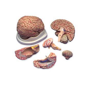  Open Box Budget Brain With Arteries Model